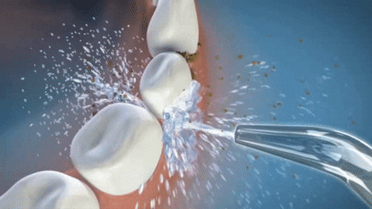 IRRIGADOR DENTAL