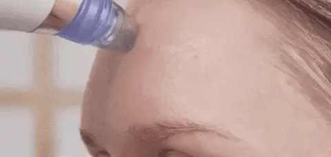 LIMPIADOR FACIAL/ LIMPIADOR DE PORO