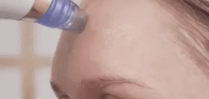 LIMPIADOR FACIAL/ LIMPIADOR DE PORO